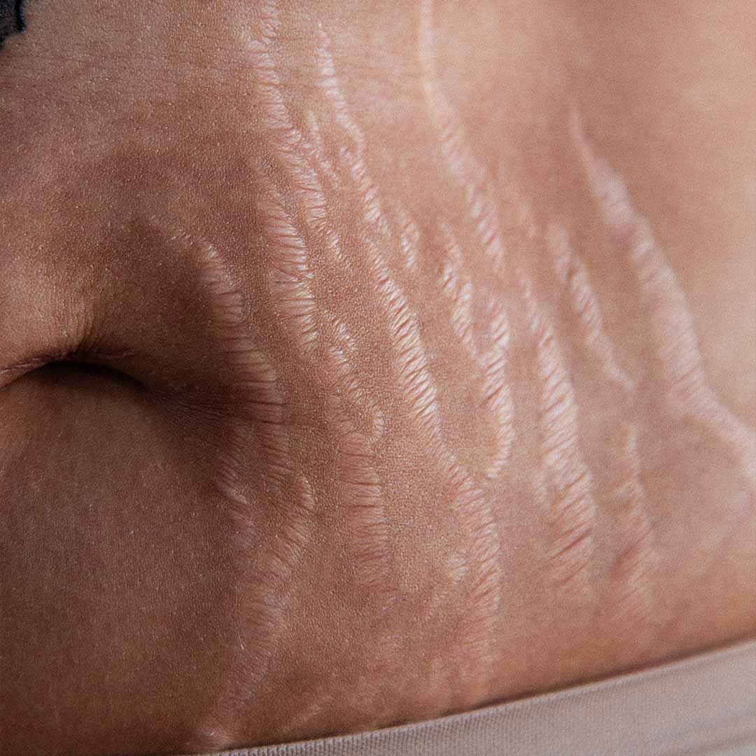 GetNaked_7